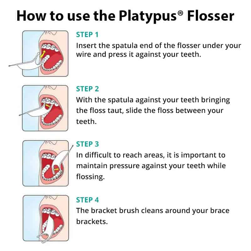 How to use the Platypus Flosser