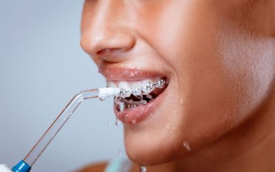 What are the best orthodontic flossers?