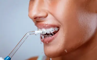 What are the best orthodontic flossers?