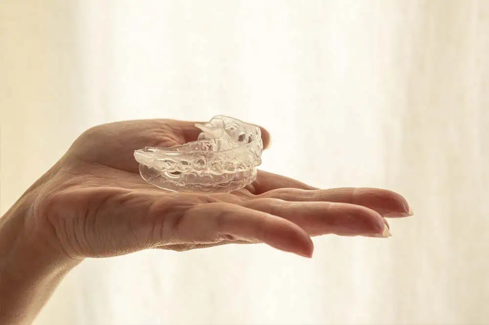 Should I invest in a retainer case?